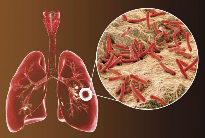 Un Llamado Urgente: Día Mundial de la Tuberculosis y el Rol Clave de la Enfermería en Chile