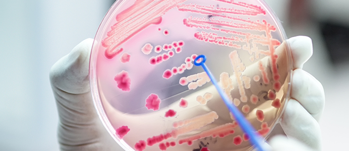 Diplomado en Microbiología Clínica