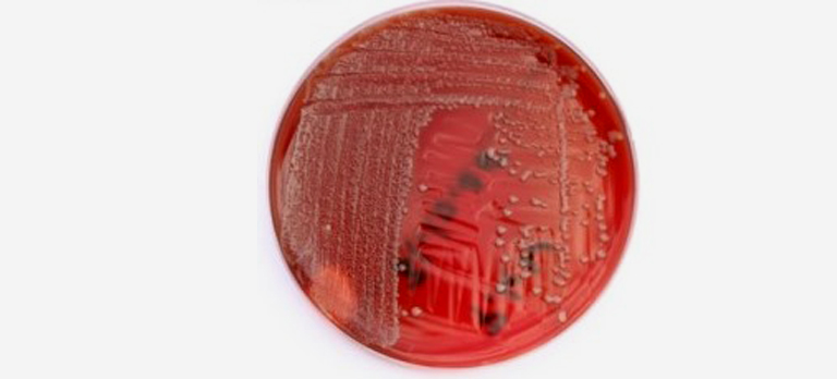 Cultivo de Corynebacterium kroppenstedtii