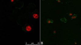 Núcleo de células CHO (A) y PC12 (B)